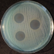 Bakterie na szalce Petriego